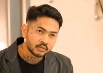 Onad Akui Punya Gejala Sindrom Peter Pan usai Rehabilitasi Narkoba